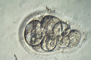 view Human embryo for IVF