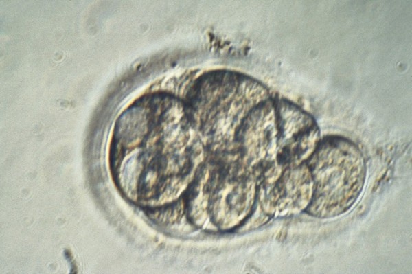 Human embryo for IVF