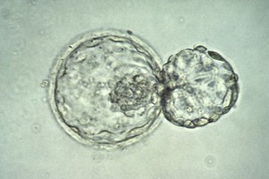 view Human blastocyst hatching