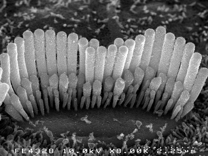 Hair cell of inner ear