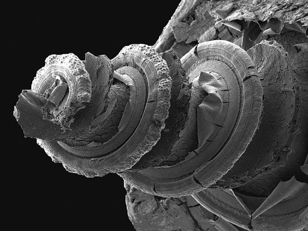 Cochlea of the inner ear