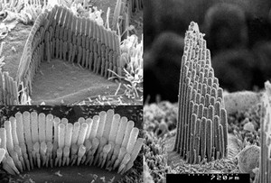 view Hair cells of inner ear