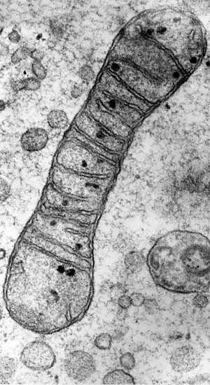 view TEM of a mitochondrion