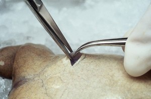 view Xenopus frog egg removal, 2nd incision