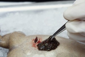 view Xenopus frog egg removal for patch clamping studies