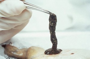 view Xenopus frog egg removal