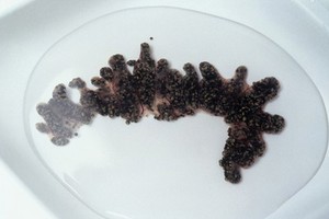 view Xenopus frog eggs, just removed