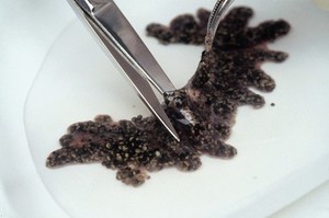 view Xenopus frog egg removal