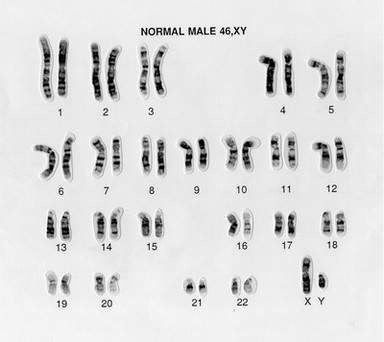 Normal male 46,XY human karyotype