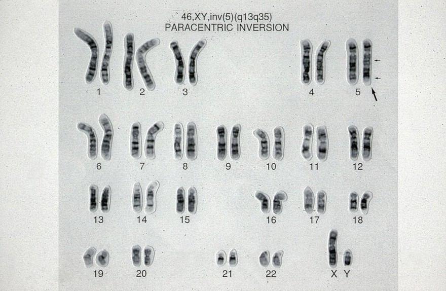 Paracentric chromosome inversion