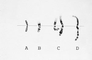 view Chromosome condensation prophase to metaphas