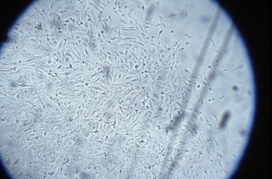 Foetal cells in amniotic fluid, low power LM
