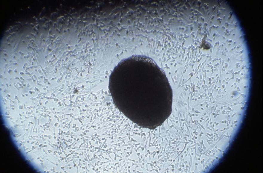 Foetal cells in amniotic fluid, + colchicine