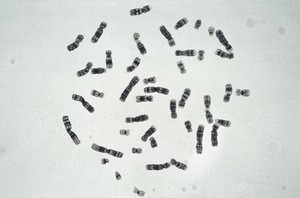 view Normal human male metaphase, Y banding