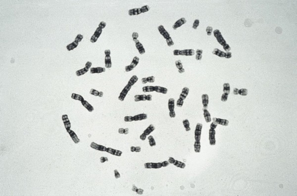 Normal human male metaphase, Y banding