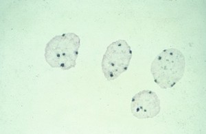 view Interphase cells showing pentameric X