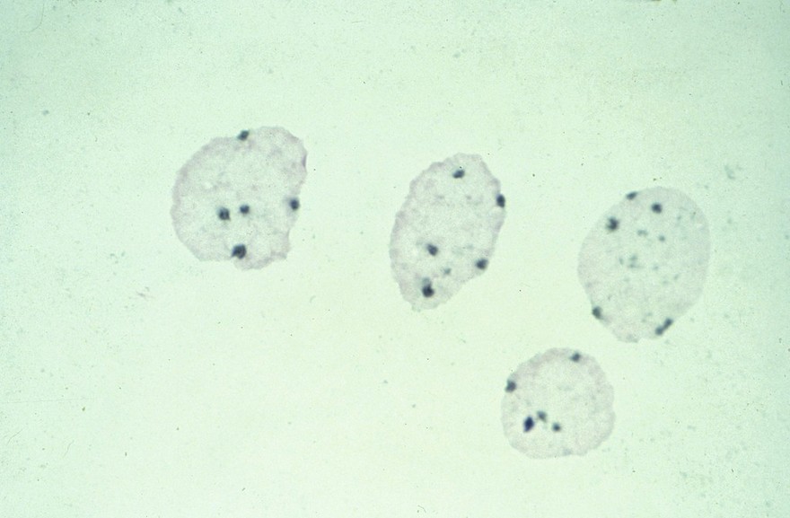 Interphase cells showing pentameric X