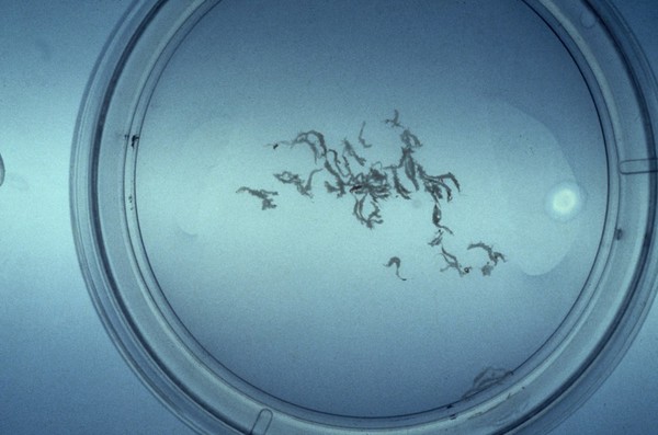 Chorionic villi samples in petri dish