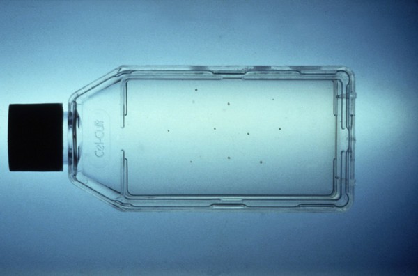 Chorionic villi explants in culture flask