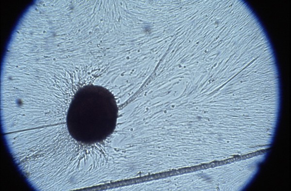 Foetal cells from amniotic fluid in culture