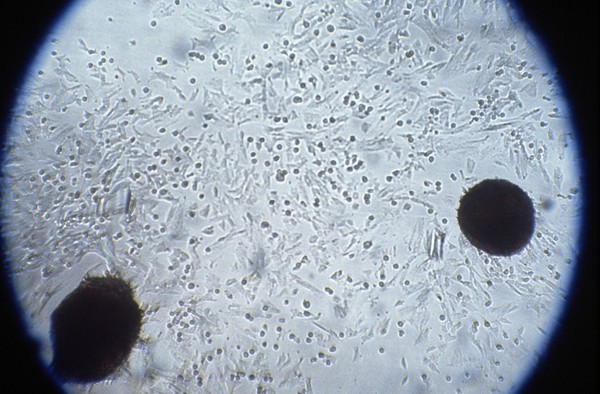 Foetal cells from amniotic fluid, colchicine