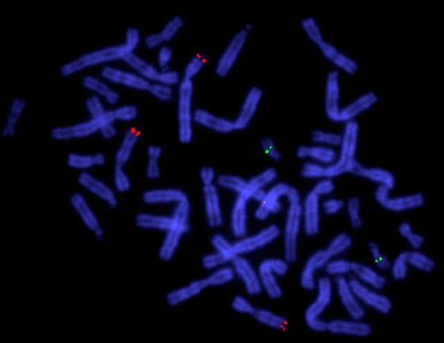 Human metaphase, translocation, cosmid probe