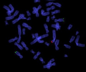 view Unbalanced translocation, cosmid probe