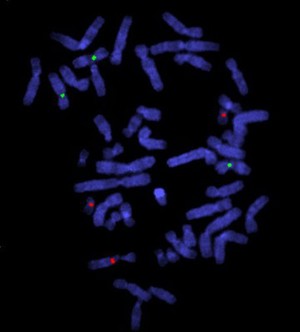 view Whole arm translocation, centromere probes