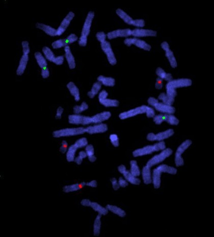 Whole arm translocation, centromere probes