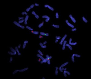 view Translocation shown using centromere probes