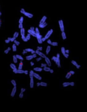 Translocation - use of cosmid probe