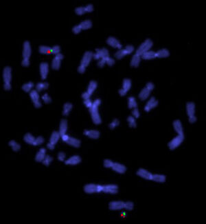 view Turner's syndrome, centromere & cosmid probe