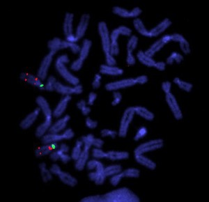 view Prader Willi & Angelman's syndromes - probes