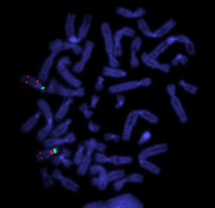 Prader Willi & Angelman's syndromes - probes