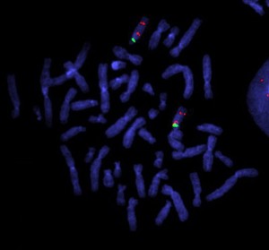 view Prader Willi & Angelman's syndromes - probes