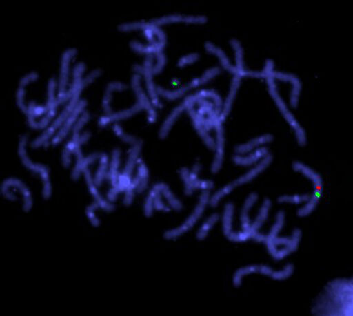 Turner's stndrome, centromere & cosmid probe