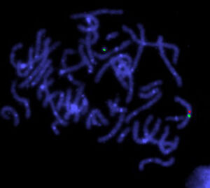 view Turner's stndrome, centromere & cosmid probe