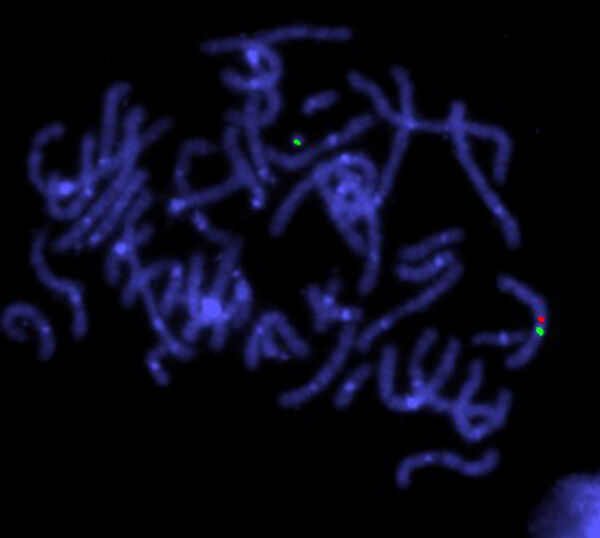 Turner's stndrome, centromere & cosmid probe