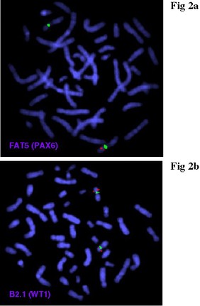 Aniridia + deletion, FISH probes