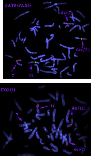 view Aniridia + translocation, FISH & cosmid prob