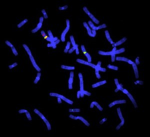 view Duchenne muscular dystrophy deletion, FISH