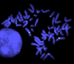 view Duchenne muscular dystrophy control, FISH