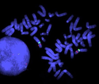 Duchenne muscular dystrophy control, FISH