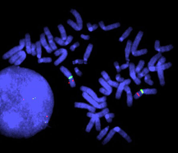 Duchenne muscular dystrophy control, FISH