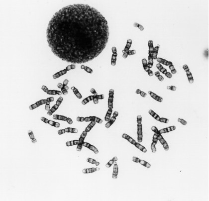 Human metaphase, normal male + nucleus