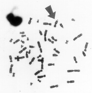 Fragile X metaphase spread + nucleus