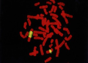 view Use of DNA probe on c-some 9 heterochromatin