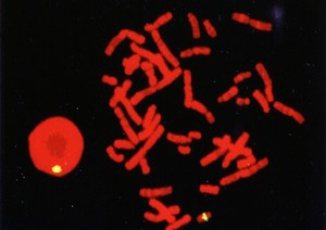 view DNA probe for Y chromosome, meta/interphase