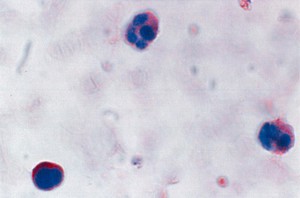 view Fragile X diagnostic test - normal