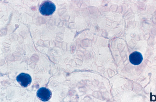 Fragile X diagnostic test - male, no stain